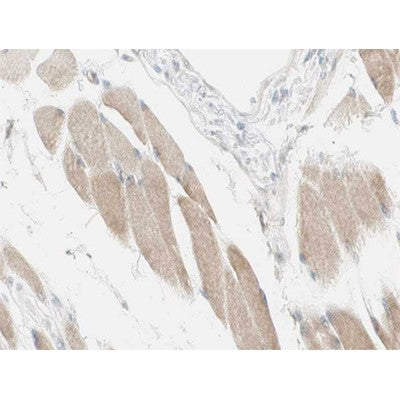 AF0351 at 1/100 staining human Skeletal muscle tissue sections by IHC-P. The tissue was formaldehyde fixed and a heat mediated antigen retrieval step in citrate buffer was performed. The tissue was then blocked and incubated with the antibody for 1.5 hours at 22¡ãC. An HRP conjugated goat anti-rabbit antibody was used as the secondary