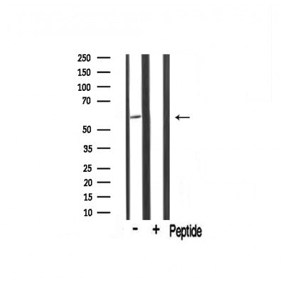 Western blot analysis of TRIM16 Antibody expression in Mouse muscle tissue lysates.The lane on the right is treated with the antigen-specific peptide.