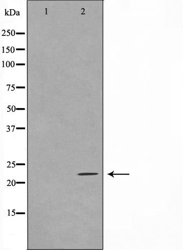 Western blot analysis on HuvEc cell lysate using TFIP8 Antibody,The lane on the left is treated with the antigen-specific peptide.