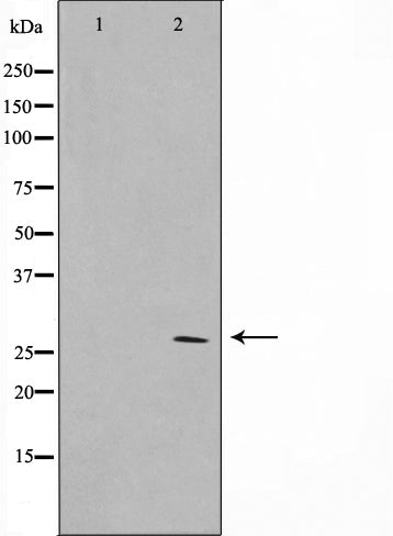 AF0724 staining HuvEc by IF/ICC. The sample were fixed with PFA and permeabilized in 0.1% Triton X-100,then blocked in 10% serum for 45 minutes at 25¡ãC. The primary antibody was diluted at 1/200 and incubated with the sample for 1 hour at 37¡ãC. An  Alexa Fluor 594 conjugated goat anti-rabbit IgG (H+L) Ab, diluted at 1/600, was used as the secondary antibod