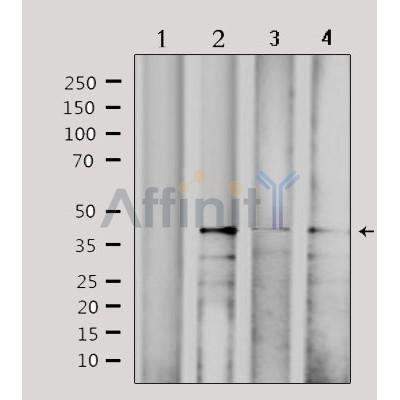 Western blot analysis of extracts from various samples, using CBX6 Antibody. Lane 1: 293  treated with  blocking peptide; Lane 2: 293; Lane 3: HepG2; Lane 4: Hela; 