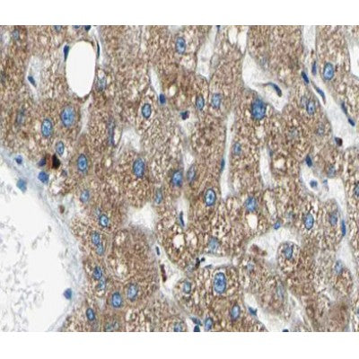 AF0272 at 1/100 staining human liver tissue sections by IHC-P. The tissue was formaldehyde fixed and a heat mediated antigen retrieval step in citrate buffer was performed. The tissue was then blocked and incubated with the antibody for 1.5 hours at 22¡ãC. An HRP conjugated goat anti-rabbit antibody was used as the secondary
