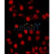 Western blot analysis of extracts from VERO, using ZNF682 Antibody. The lane on the left was treated with blocking peptide.