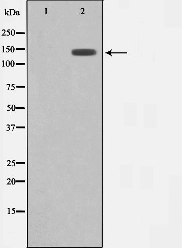 Western blot analysis on HuvEc cell lysate using MEKKK 4 Antibody,The lane on the left is treated with the antigen-specific peptide.