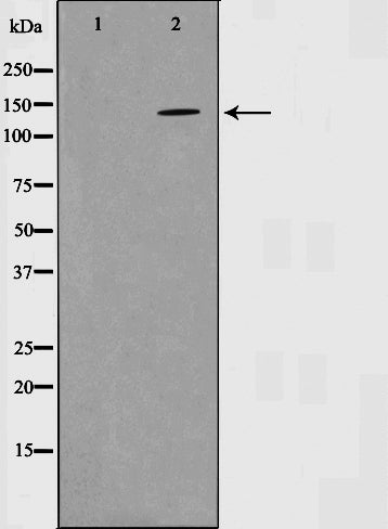 Western blot analysis on SK-OV3 cell lysate using EGFR Antibody,The lane on the left is treated with the antigen-specific peptide.