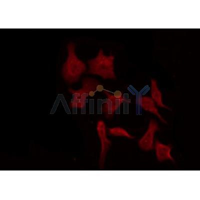 AF0436 staining SK-OV3 by IF/ICC. The sample were fixed with PFA and permeabilized in 0.1% Triton X-100,then blocked in 10% serum for 45 minutes at 25¡ãC. The primary antibody was diluted at 1/200 and incubated with the sample for 1 hour at 37¡ãC. An  Alexa Fluor 594 conjugated goat anti-rabbit IgG (H+L) Ab, diluted at 1/600, was used as the secondary antibod