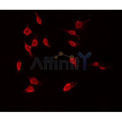AF0493 staining HuvEc/RAW by IF/ICC. The sample were fixed with PFA and permeabilized in 0.1% Triton X-100,then blocked in 10% serum for 45 minutes at 25¡ãC. The primary antibody was diluted at 1/200 and incubated with the sample for 1 hour at 37¡ãC. An  Alexa Fluor 594 conjugated goat anti-rabbit IgG (H+L) Ab, diluted at 1/600, was used as the secondary antibod