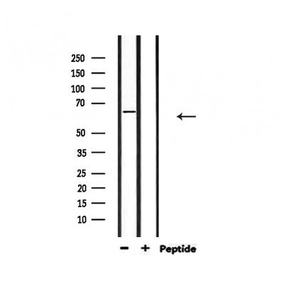 Western blot analysis of extracts from mouse lung, using KITH_EBV Antibody.