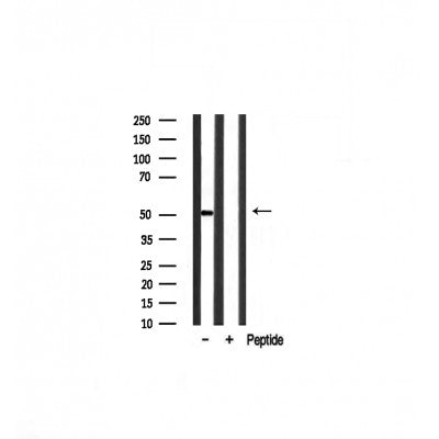 Western blot analysis on mouse muscle lysate using EGR2 Antibody