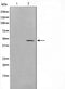 Western blot analysis on HepG2 cell lysate using CEBPB Antibody,The lane on the left is treated with the antigen-specific peptide.
