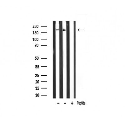 Western blot analysis of TAF1 Antibody expression in mouse heart and rat muscle tissues lysates.The lane on the right is treated with the antigen-specific peptide.