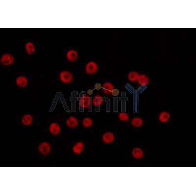 AF0273 staining COS7 by IF/ICC. The sample were fixed with PFA and permeabilized in 0.1% Triton X-100,then blocked in 10% serum for 45 minutes at 25¡ãC. The primary antibody was diluted at 1/200 and incubated with the sample for 1 hour at 37¡ãC. An  Alexa Fluor 594 conjugated goat anti-rabbit IgG (H+L) Ab, diluted at 1/600, was used as the secondary antibod