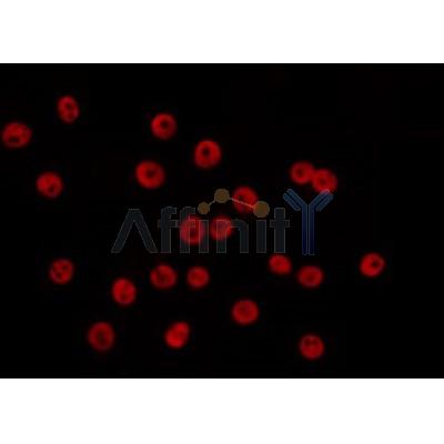 AF0273 staining COS7 by IF/ICC. The sample were fixed with PFA and permeabilized in 0.1% Triton X-100,then blocked in 10% serum for 45 minutes at 25¡ãC. The primary antibody was diluted at 1/200 and incubated with the sample for 1 hour at 37¡ãC. An  Alexa Fluor 594 conjugated goat anti-rabbit IgG (H+L) Ab, diluted at 1/600, was used as the secondary antibod