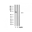 Western blot analysis of extracts from 293, using PIAS2 Antibody.