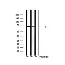 Western blot analysis of extracts from 293 and Hela, using PIAS2 Antibody.