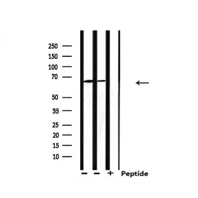 Western blot analysis of extracts from 293 and Hela, using PIAS2 Antibody.