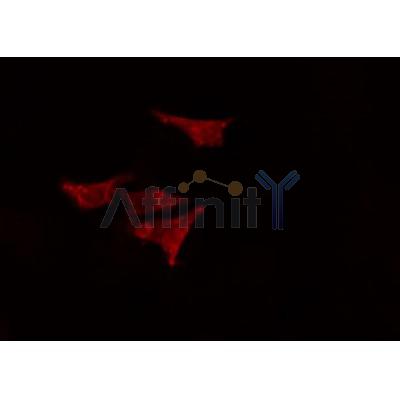 AF0463 staining HeLa cells by IF/ICC. The sample were fixed with PFA and permeabilized in 0.1% Triton X-100,then blocked in 10% serum for 45 minutes at 25¡ãC. The primary antibody was diluted at 1/200 and incubated with the sample for 1 hour at 37¡ãC. An  Alexa Fluor 594 conjugated goat anti-rabbit IgG (H+L) antibody(Cat.