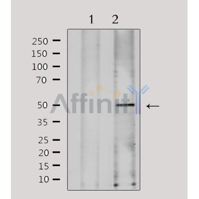 AF0525 staining Hela by IF/ICC. The sample were fixed with PFA and permeabilized in 0.1% Triton X-100,then blocked in 10% serum for 45 minutes at 25¡ãC. The primary antibody was diluted at 1/200 and incubated with the sample for 1 hour at 37¡ãC. An  Alexa Fluor 594 conjugated goat anti-rabbit IgG (H+L) Ab, diluted at 1/600, was used as the secondary antibod
