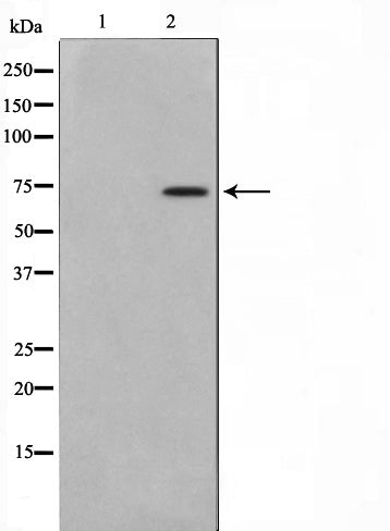 Western blot analysis on HT29 cell lysate using MED17 Antibody,The lane on the left is treated with the antigen-specific peptide.