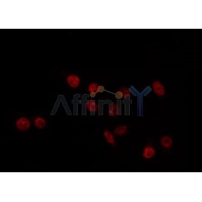 AF0440 staining HT29 by IF/ICC. The sample were fixed with PFA and permeabilized in 0.1% Triton X-100,then blocked in 10% serum for 45 minutes at 25¡ãC. The primary antibody was diluted at 1/200 and incubated with the sample for 1 hour at 37¡ãC. An  Alexa Fluor 594 conjugated goat anti-rabbit IgG (H+L) Ab, diluted at 1/600, was used as the secondary antibod