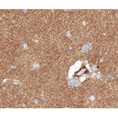 AF0162 at 1/100 staining human brain tissue sections by IHC-P. The tissue was formaldehyde fixed and a heat mediated antigen retrieval step in citrate buffer was performed. The tissue was then blocked and incubated with the antibody for 1.5 hours at 22¡ãC. An HRP conjugated goat anti-rabbit antibody was used as the secondary