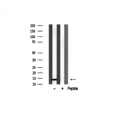 AF0854 at 1/100 staining human Kidney tissue sections by IHC-P. The tissue was formaldehyde fixed and a heat mediated antigen retrieval step in citrate buffer was performed. The tissue was then blocked and incubated with the antibody for 1.5 hours at 22¡ãC. An HRP conjugated goat anti-rabbit antibody was used as the secondary