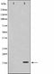 AF0866 staining HepG2 by IF/ICC. The sample were fixed with PFA and permeabilized in 0.1% Triton X-100,then blocked in 10% serum for 45 minutes at 25¡ãC. The primary antibody was diluted at 1/200 and incubated with the sample for 1 hour at 37¡ãC. An  Alexa Fluor 594 conjugated goat anti-rabbit IgG (H+L) Ab, diluted at 1/600, was used as the secondary antibod