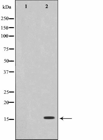 AF0866 staining HepG2 by IF/ICC. The sample were fixed with PFA and permeabilized in 0.1% Triton X-100,then blocked in 10% serum for 45 minutes at 25¡ãC. The primary antibody was diluted at 1/200 and incubated with the sample for 1 hour at 37¡ãC. An  Alexa Fluor 594 conjugated goat anti-rabbit IgG (H+L) Ab, diluted at 1/600, was used as the secondary antibod