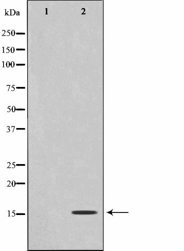 AF0873 at 1/100 staining human Brain tissue sections by IHC-P. The tissue was formaldehyde fixed and a heat mediated antigen retrieval step in citrate buffer was performed. The tissue was then blocked and incubated with the antibody for 1.5 hours at 22¡ãC. An HRP conjugated goat anti-rabbit antibody was used as the secondary