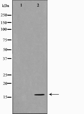 AF0862 staining HepG2 by IF/ICC. The sample were fixed with PFA and permeabilized in 0.1% Triton X-100,then blocked in 10% serum for 45 minutes at 25¡ãC. The primary antibody was diluted at 1/200 and incubated with the sample for 1 hour at 37¡ãC. An  Alexa Fluor 594 conjugated goat anti-rabbit IgG (H+L) Ab, diluted at 1/600, was used as the secondary antibod