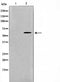 AF0829 staining HeLa cells by IF/ICC. The sample were fixed with PFA and permeabilized in 0.1% Triton X-100,then blocked in 10% serum for 45 minutes at 25¡ãC. The primary antibody was diluted at 1/200 and incubated with the sample for 1 hour at 37¡ãC. An  Alexa Fluor 594 conjugated goat anti-rabbit IgG (H+L) antibody(Cat.