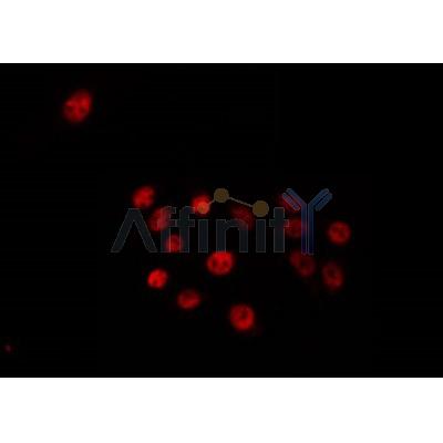 AF0483 staining 293 by IF/ICC. The sample were fixed with PFA and permeabilized in 0.1% Triton X-100,then blocked in 10% serum for 45 minutes at 25¡ãC. The primary antibody was diluted at 1/200 and incubated with the sample for 1 hour at 37¡ãC. An  Alexa Fluor 594 conjugated goat anti-rabbit IgG (H+L) Ab, diluted at 1/600, was used as the secondary antibod
