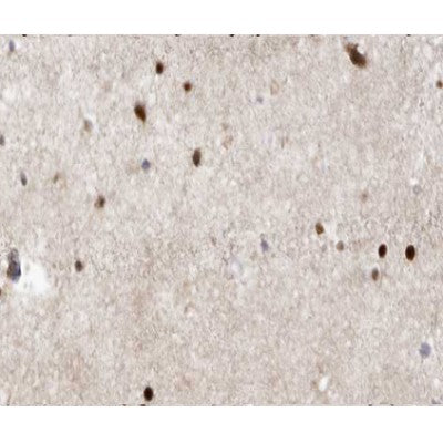 AF0163 at 1/100 staining human brain tissue sections by IHC-P. The tissue was formaldehyde fixed and a heat mediated antigen retrieval step in citrate buffer was performed. The tissue was then blocked and incubated with the antibody for 1.5 hours at 22¡ãC. An HRP conjugated goat anti-rabbit antibody was used as the secondary