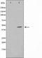Western blot analysis on HuvEc cell lysate using CD147 Antibody,The lane on the left is treated with the antigen-specific peptide.