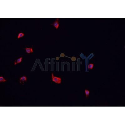 AF0410 staining CACO-2 cells by IF/ICC. The sample were fixed with PFA and permeabilized in 0.1% Triton X-100,then blocked in 10% serum for 45 minutes at 25¡ãC. The primary antibody was diluted at 1/200 and incubated with the sample for 1 hour at 37¡ãC. An  Alexa Fluor 594 conjugated goat anti-rabbit IgG (H+L) antibody(Cat.