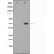 Western blot analysis of ETV4 Antibody expression in K562 cells lysates.The lane on the left is treated with the antigen-specific peptide.