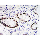 Immunohistochemical analysis of paraffin-embedded colon cancer tissues 
