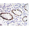 Immunohistochemical analysis of paraffin-embedded colon cancer tissues 