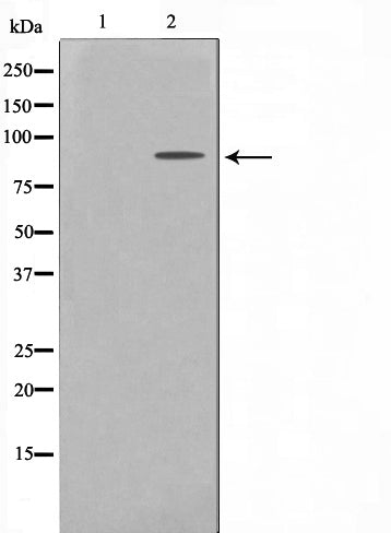 Western blot analysis on HT29 cell lysate using hnRNP M Antibody,The lane on the left is treated with the antigen-specific peptide.