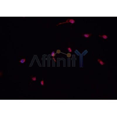 AF0481 staining CACO-2 cells by IF/ICC. The sample were fixed with PFA and permeabilized in 0.1% Triton X-100,then blocked in 10% serum for 45 minutes at 25¡ãC. The primary antibody was diluted at 1/200 and incubated with the sample for 1 hour at 37¡ãC. An  Alexa Fluor 594 conjugated goat anti-rabbit IgG (H+L) antibody(Cat.
