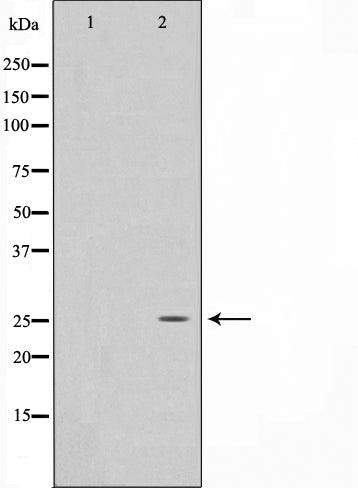 AF0560 staining HeLa by IF/ICC. The sample were fixed with PFA and permeabilized in 0.1% Triton X-100,then blocked in 10% serum for 45 minutes at 25¡ãC. The primary antibody was diluted at 1/200 and incubated with the sample for 1 hour at 37¡ãC. An  Alexa Fluor 594 conjugated goat anti-rabbit IgG (H+L) Ab, diluted at 1/600, was used as the secondary antibod
