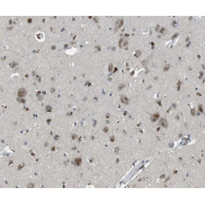 Western blot analysis of extracts from mouse brain, using TFAM Antibody. Lane 1 was treated with the antigen-specific peptide.