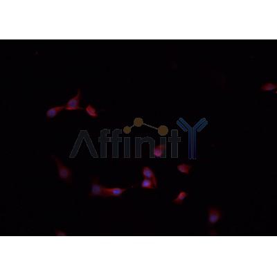 AF0164 staining A-431 cells by IF/ICC. The sample were fixed with PFA and permeabilized in 0.1% Triton X-100,then blocked in 10% serum for 45 minutes at 25¡ãC. The primary antibody was diluted at 1/200 and incubated with the sample for 1 hour at 37¡ãC. An  Alexa Fluor 594 conjugated goat anti-rabbit IgG (H+L) antibody(Cat.