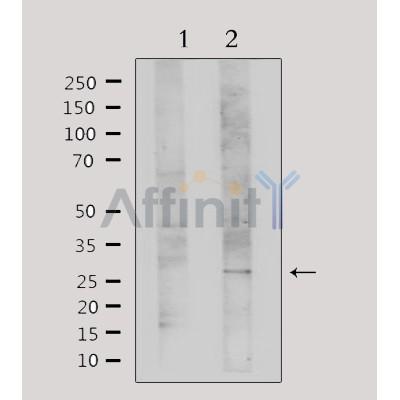 Western blot analysis of extracts from Hela, using Galectin 3 Antibody. Lane 1 was treated with the antigen-specific peptide.