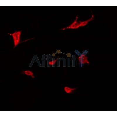 AF0469 staining COLO205 by IF/ICC. The sample were fixed with PFA and permeabilized in 0.1% Triton X-100,then blocked in 10% serum for 45 minutes at 25¡ãC. The primary antibody was diluted at 1/200 and incubated with the sample for 1 hour at 37¡ãC. An  Alexa Fluor 594 conjugated goat anti-rabbit IgG (H+L) Ab, diluted at 1/600, was used as the secondary antibod