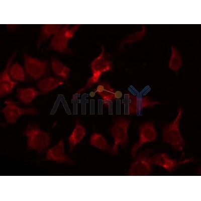 AF0707 staining Hela by IF/ICC. The sample were fixed with PFA and permeabilized in 0.1% Triton X-100,then blocked in 10% serum for 45 minutes at 25¡ãC. The primary antibody was diluted at 1/200 and incubated with the sample for 1 hour at 37¡ãC. An  Alexa Fluor 594 conjugated goat anti-rabbit IgG (H+L) Ab, diluted at 1/600, was used as the secondary antibod