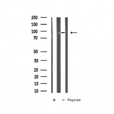Western blot analysis on Jurkat cell lysate using MTA1 Antibody