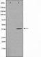 AF0592 staining COLO205 by IF/ICC. The sample were fixed with PFA and permeabilized in 0.1% Triton X-100,then blocked in 10% serum for 45 minutes at 25¡ãC. The primary antibody was diluted at 1/200 and incubated with the sample for 1 hour at 37¡ãC. An  Alexa Fluor 594 conjugated goat anti-rabbit IgG (H+L) Ab, diluted at 1/600, was used as the secondary antibod