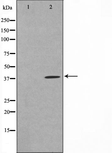 AF0592 staining COLO205 by IF/ICC. The sample were fixed with PFA and permeabilized in 0.1% Triton X-100,then blocked in 10% serum for 45 minutes at 25¡ãC. The primary antibody was diluted at 1/200 and incubated with the sample for 1 hour at 37¡ãC. An  Alexa Fluor 594 conjugated goat anti-rabbit IgG (H+L) Ab, diluted at 1/600, was used as the secondary antibod