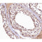 AF0165 at 1/100 staining human Testis tissue sections by IHC-P. The tissue was formaldehyde fixed and a heat mediated antigen retrieval step in citrate buffer was performed. The tissue was then blocked and incubated with the antibody for 1.5 hours at 22¡ãC. An HRP conjugated goat anti-rabbit antibody was used as the secondary